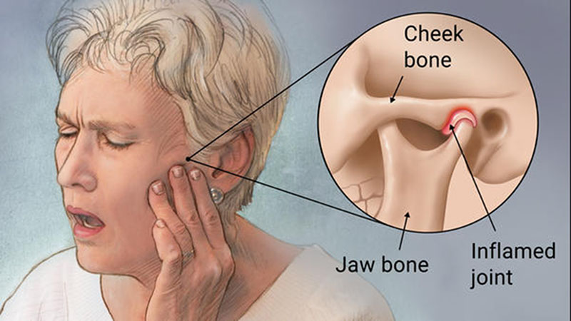 Jaw Pain Treatment